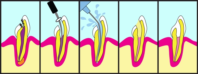 Endodontia