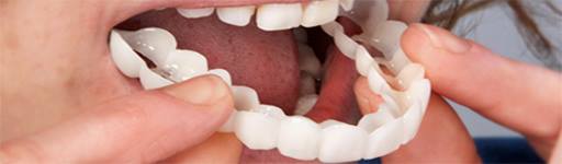 Em 1 dia consiga um sorriso perfeito para a ocasião.